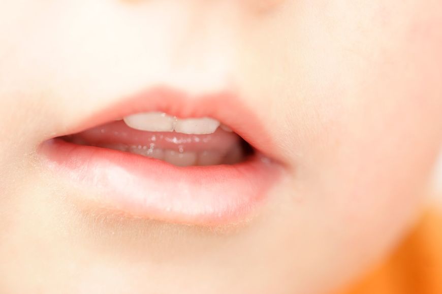 口が半開きになっている子供の口元