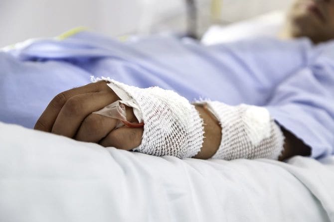 治療を受ける患者